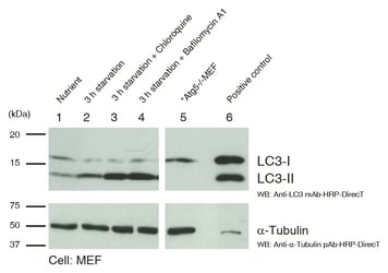 autophagy_watch_WB